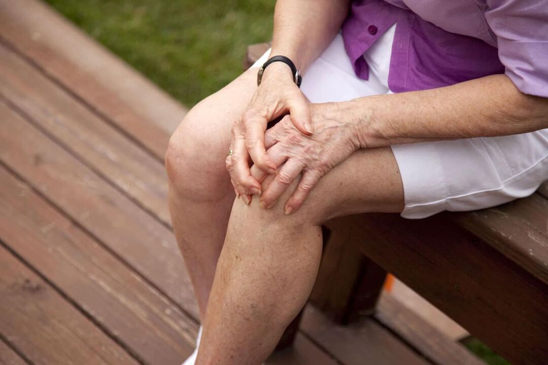 Kniegelenksarthrose ist bei älteren Frauen weit verbreitet