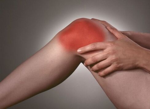 Kniegelenks -Osteoarthritis
