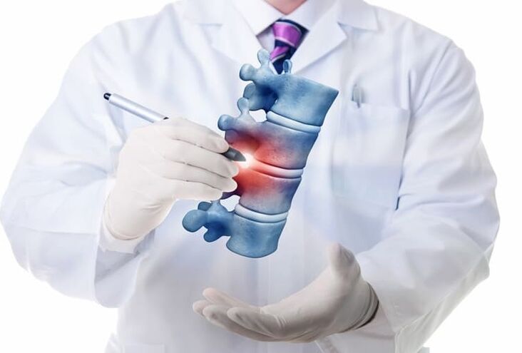 Wirbelsäulenverletzungen aufgrund thorakaler Osteochondrose.
